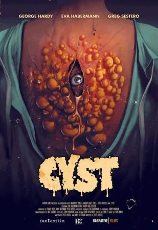 فيلم Cyst 2021 مترجم